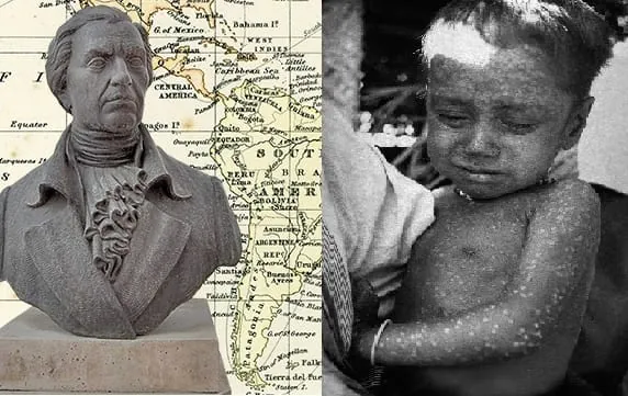 Busto de Francisco Javier Balmis y un niño con viruela, representando la Real Expedición Filantrópica de la Vacuna