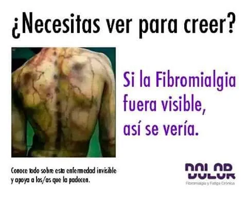 Campaña de concienciación sobre la fibromialgia con una imagen de una espalda con marcas de dolor y el texto ¿Necesitas ver para creer? Si la fibromialgia fuera visible, así se vería.